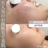 モアトゥインクル 東広島西条店(MORE twinkle)