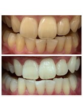 ホワイトプラン/6回目の変化！！