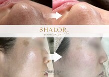 シャロル(SHALOR)