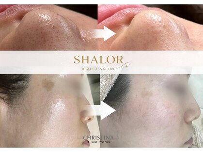シャロル(SHALOR)の写真