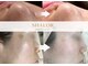 シャロル(SHALOR)の写真