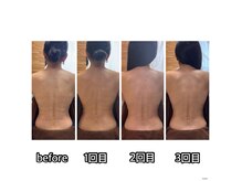 アイラッシュサロン シェリー(Cherie)の雰囲気（LPSリンパマッサージ2週間に一回のケアでの変化）