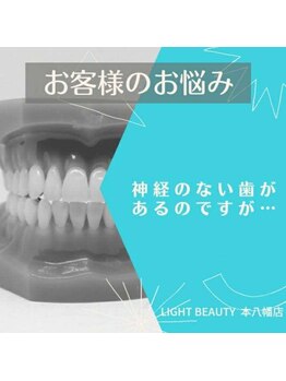 ライトビューティー 本八幡店(LIGHT BEAUTY)/一度ご相談ください!