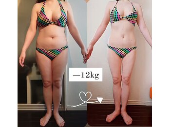 レナトゥス 銀座(Renatus)/12kg☆Before/After【痩身】