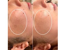 ソレイユ(Soleil)の雰囲気（シミ改善だけじゃない！あらゆるお肌トラブルにアプローチ◎）