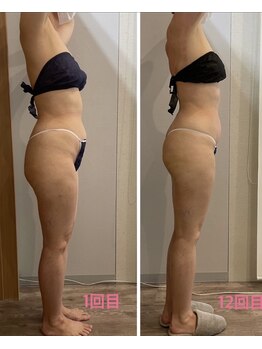 ルプリュシュ ルフレ(Le plus reflet)/カッピング!