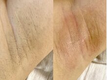 モア30(more30)/【ビフォーアフター】