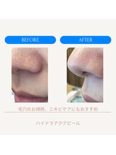 ムーンライズ(moonrise)/