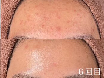 ホワイトアクア 四日市店(WHITE AQUA)/圧倒的結果重視