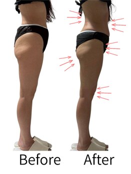 ララナ バイ カノア(LALANA by kanoa)/