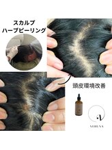 ココ 2号店(CoCo)/夏前の今、スカルプ棘ケア
