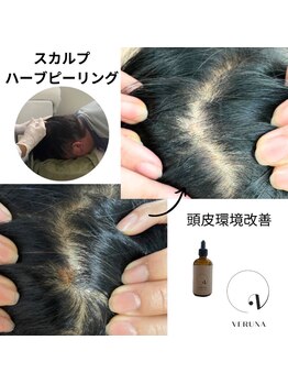 ココ 2号店(CoCo)/夏前の今、スカルプ棘ケア