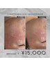 【CHRISTINA初めての方・60日以内再来店様】CHRISTINAトリートメント9種