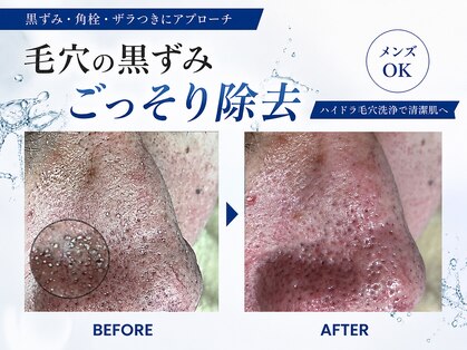 ピアリーノ(Pialino)の写真