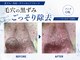 ピアリーノ(Pialino)の写真
