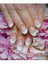 アイネイル(iNAIL)/
