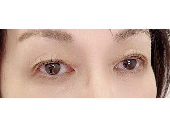 アメリオレフチュール(ameliorer futur)/進化系高濃度トリートメント