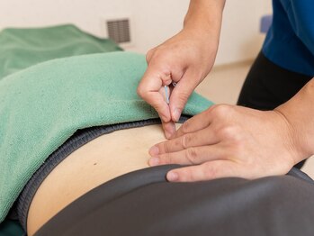 はくさん和鍼灸整骨院/腰の施術