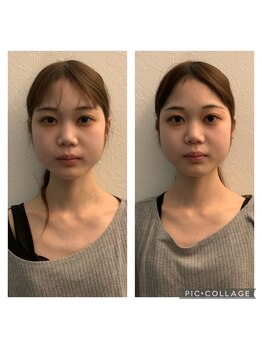 アニュームーン 上本町店(a New Moon)/