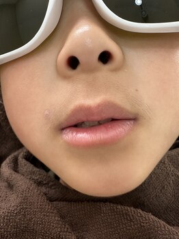 ビーンズ(BEANS)/