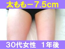 ユリシード 大阪分院(Ulyseeed)/太もも－７．５ｃｍという事実♪