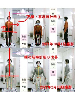 姫路なごみ整体院 なごみ鍼灸院/改善例（身体の歪みと耳鳴り）