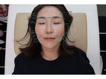 ことぶき整骨院/美容鍼50分コース