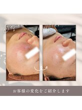 ルーク(Luke)/ビフォーアフター