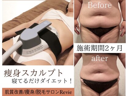 レヴィー(Revie)の写真