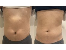 フラットベリー 恵比寿(Flat BELLY)/上半身集中100分コース