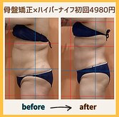 ハンズ鍼灸接骨院小牧院 美容整体ハンズ(美容整体hands)