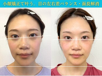 ナチュラルパーフェクトフェイス 新宿/