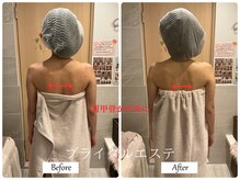 リノ(Lino)/ブライダルエステ