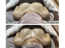 サロン ルオントの雰囲気（【イチオシ★ボンボンバスト】ふわふわマシュマロバストへ）