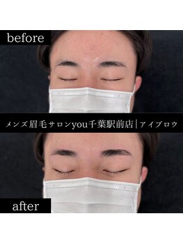 ユー 千葉駅前店(you)/ビフォ－アフター写真