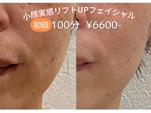 ヴィヴィの雰囲気（実感できる！結果にこだわった特殊なオールハンド技術★）