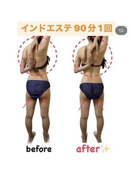 メゾンドケー(Maison de K)/90分施術 Before→After