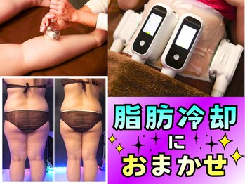 サニー(SUNNIE)の写真/【都度払い有♪勧誘なし】お腹/二の腕/太ももなど気になる部分を脂肪冷却で解決！手ごわいセル脂肪にも◎