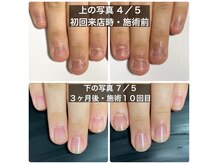自爪育成コース導入サロン～3ヵ月で丈夫で縦長爪へと導きます～