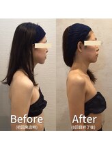 小顔フェイスラボ 瀬田店(小顔 Face Labo.)/小顔＆整体コルギの変化