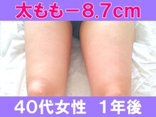 ユリシード 大阪分院(Ulyseeed)/４０代でも太もも－8.７ｃｍ ♪