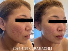 ブレスビューティー(BLESS BEAUTY)の雰囲気（韓国技術が日本上陸しBLESSが姶良初導入！根本原因にアプローチ）