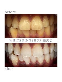 ホワイトニングショップ 姫路店/ホワイトニング