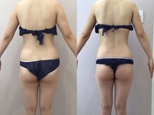 ビラ 銀座店(BILA)/キャビラジ