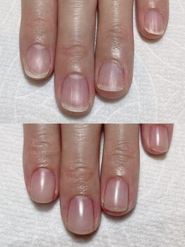 シュプール(Spur)の写真/【自爪育成/深爪育成★】噛み爪、深爪などにお悩みの方にも◎ダメージを最小限に！フィルイン導入店♪