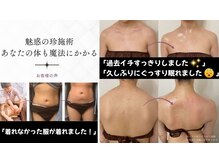 リビーナス(Re.venus)