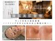 ダイヤモンド リーエンダ(Diamond leende)の写真