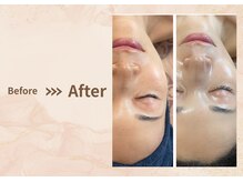 プラム(plum)/セルマン