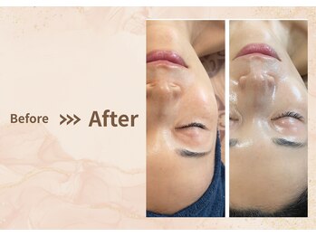 プラム(plum)/セルマン