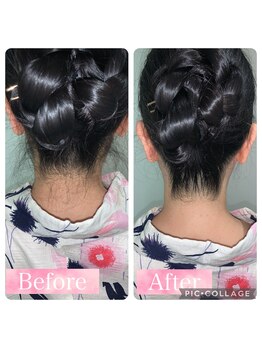 リヒト(LiHiTO)/うなじの脱毛☆１回